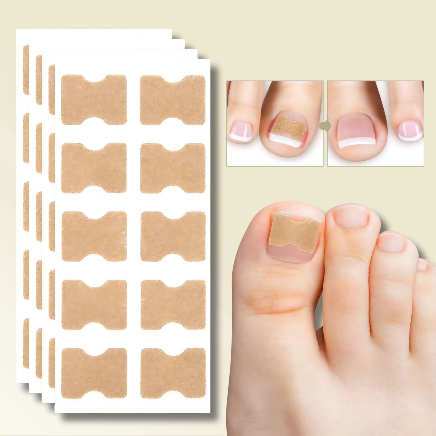 10+10 Gratis FixaNail Direkte Nagelreparatur