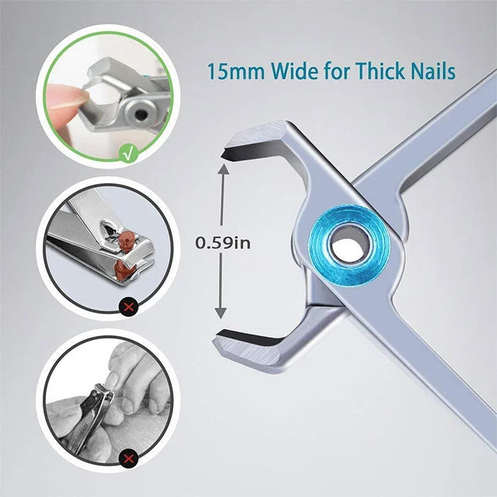 PrecisionClip | Hochwertiger multifunktionaler Nagelknipser