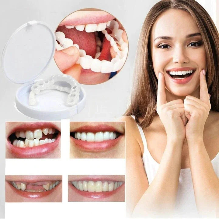 Snap on Smile Veneers (Oben & Unten)