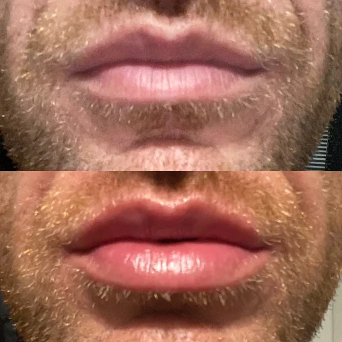 Sofortiges Lippenvolumen-Serum