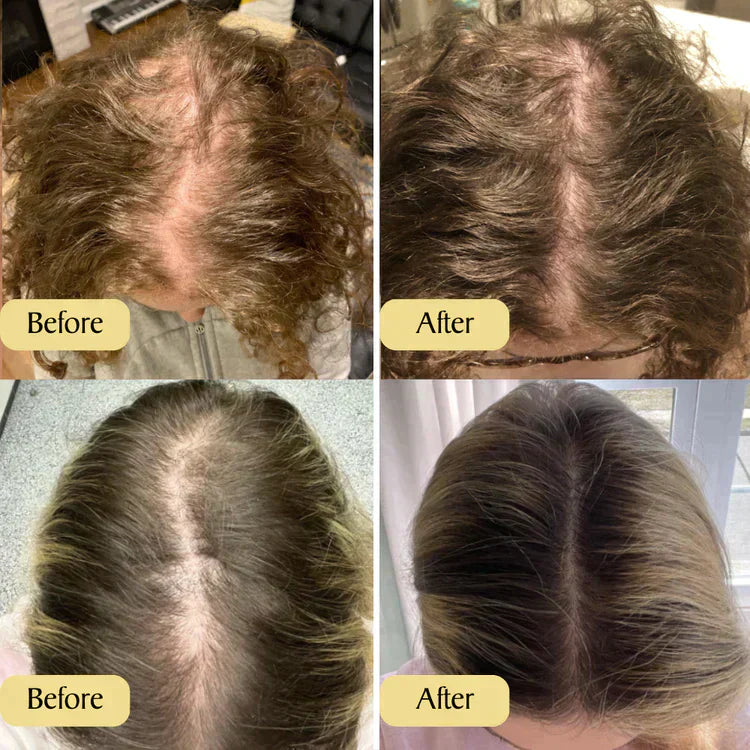 Natürliches Haarwachstumsöl