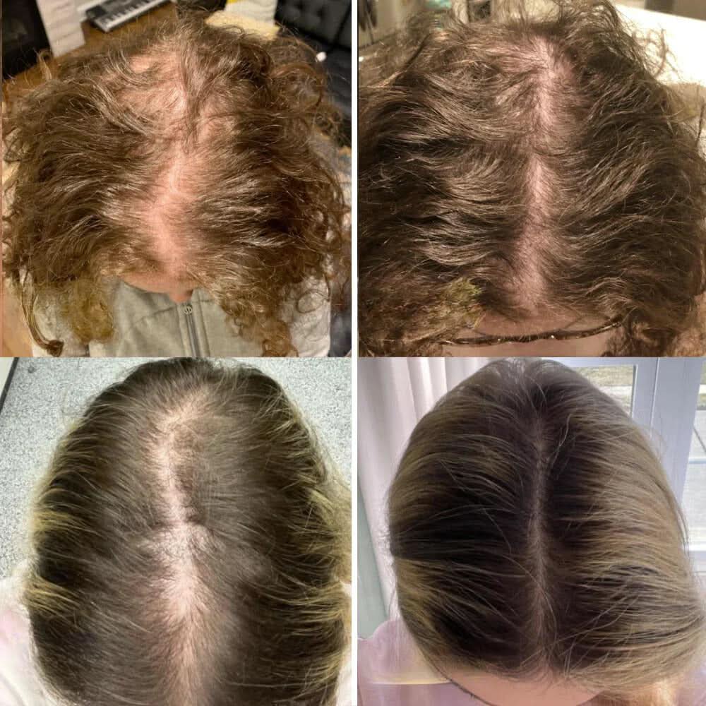 Ihr natürliches Öl für Haarwachstum