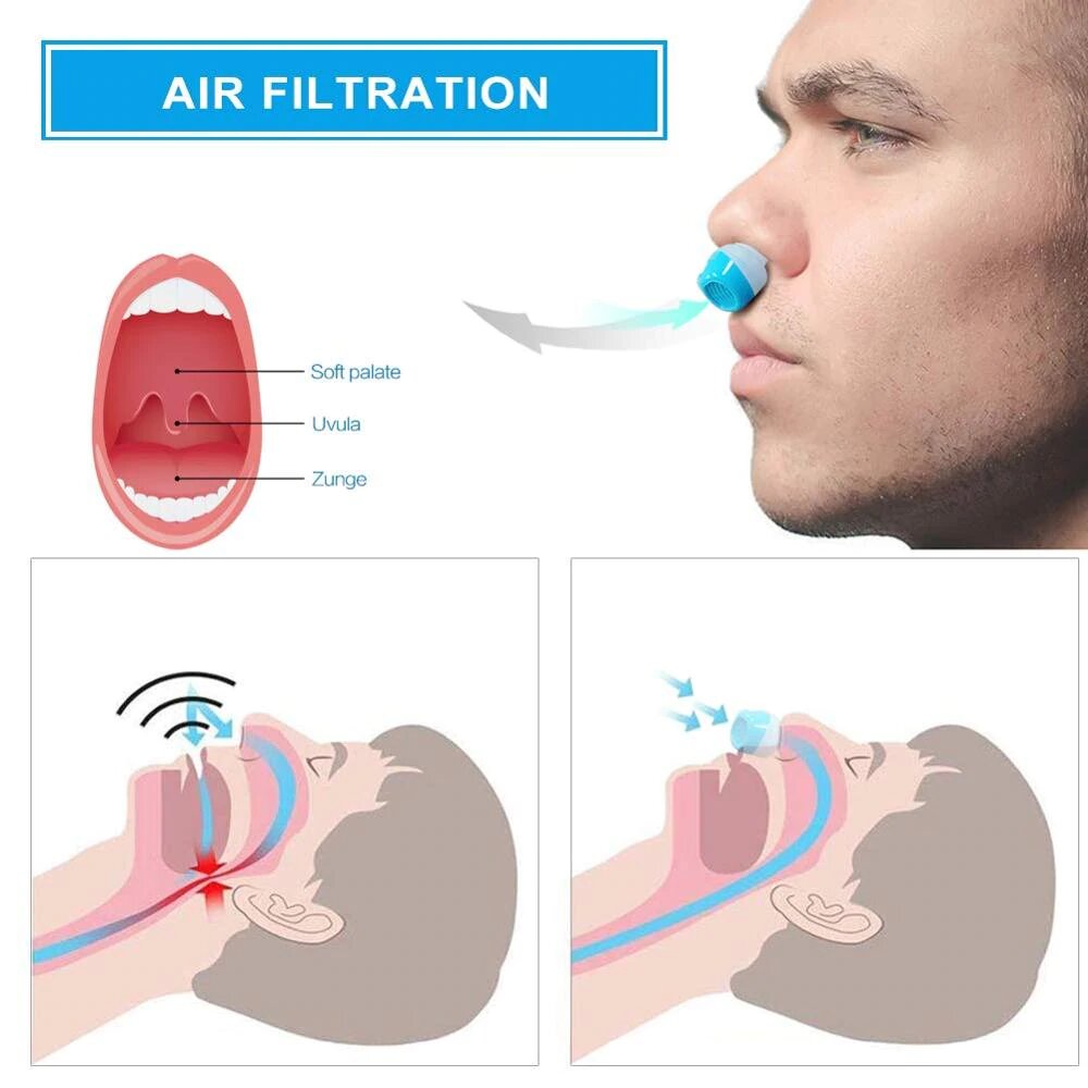 Anti-Schnarch-Gerät | Schlauchloses, maskenloses Mikro-CPAP