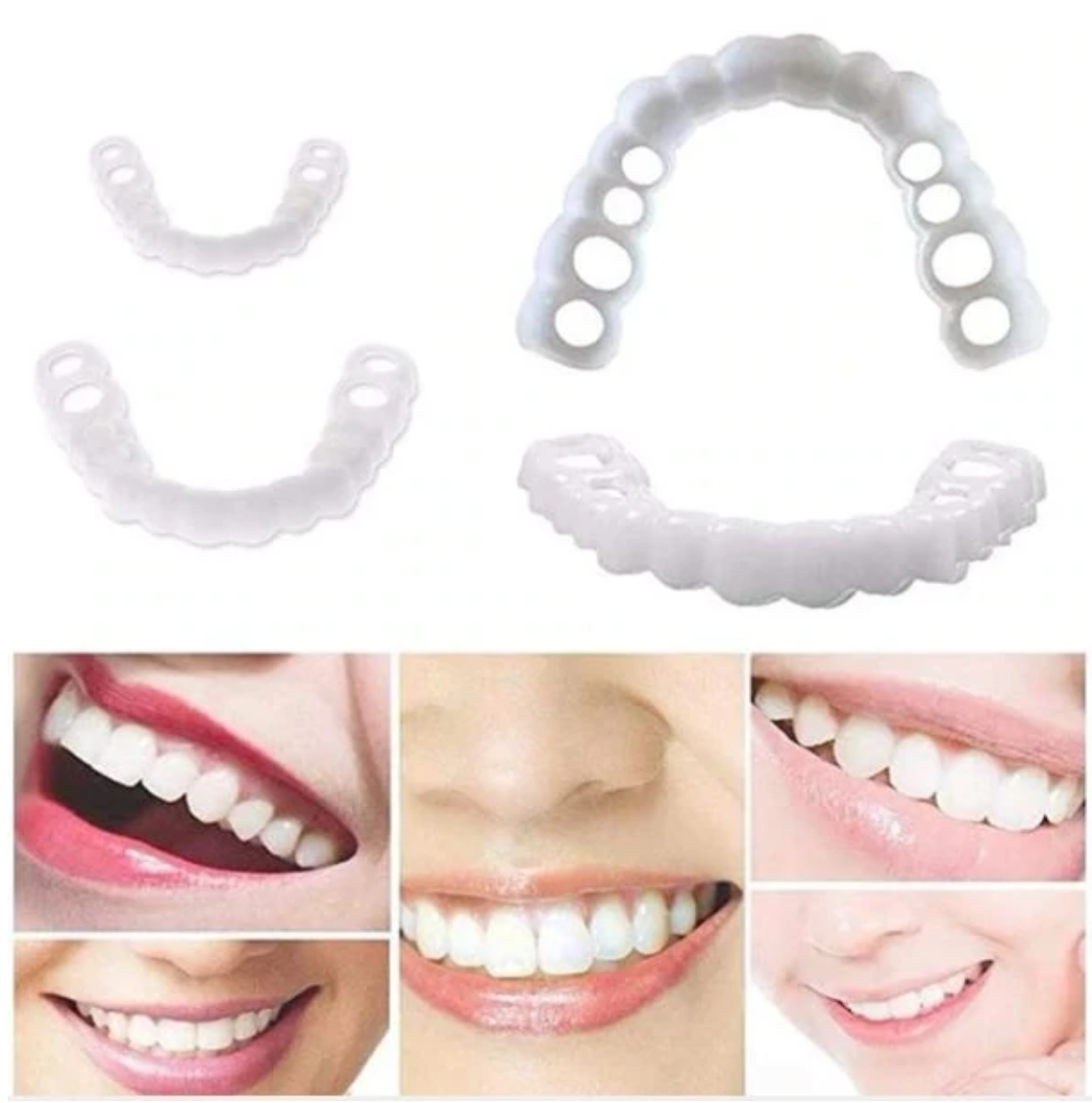 HappySmile Facetset | Wiederverwendbare Ober- und Unterfacetten für ein strahlendes Lächeln