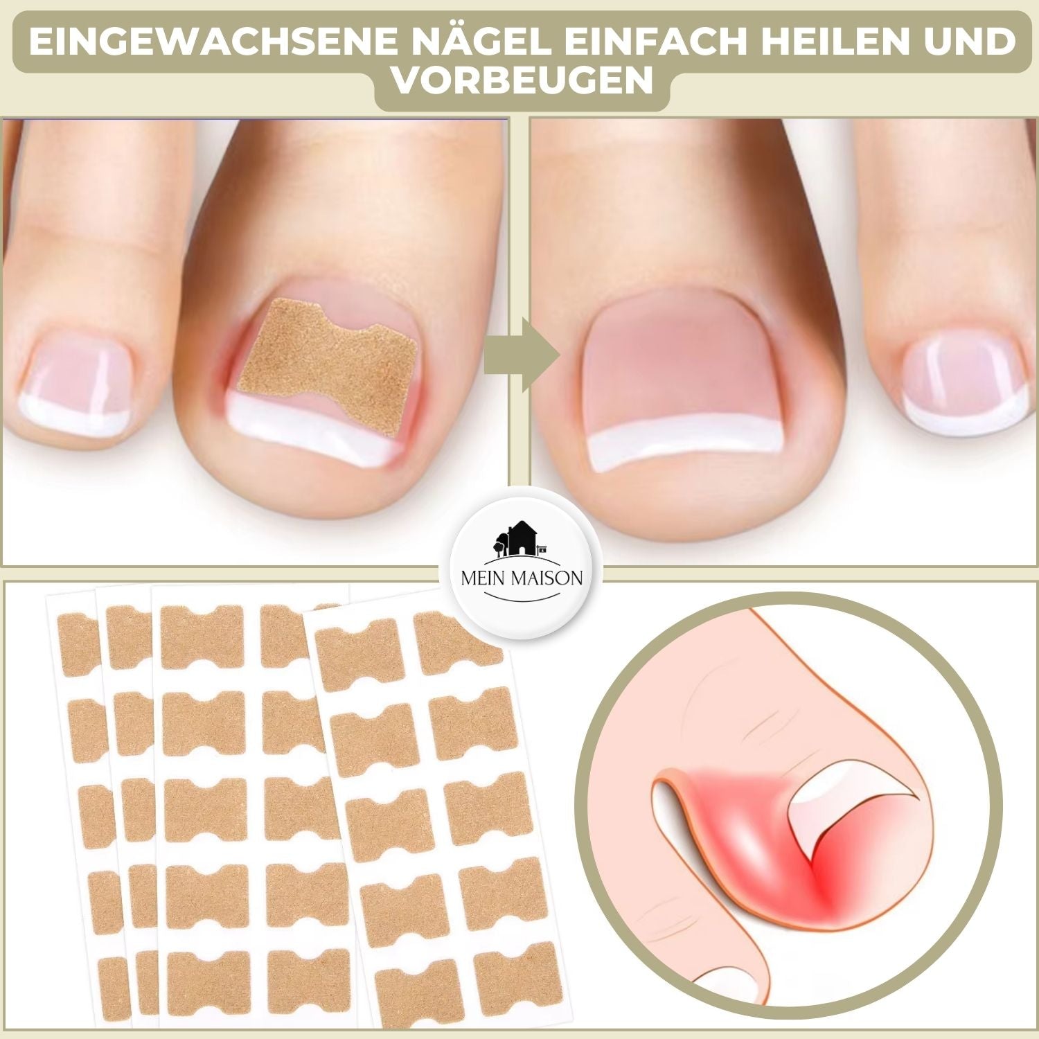 10+10 Gratis FixaNail Direkte Nagelreparatur