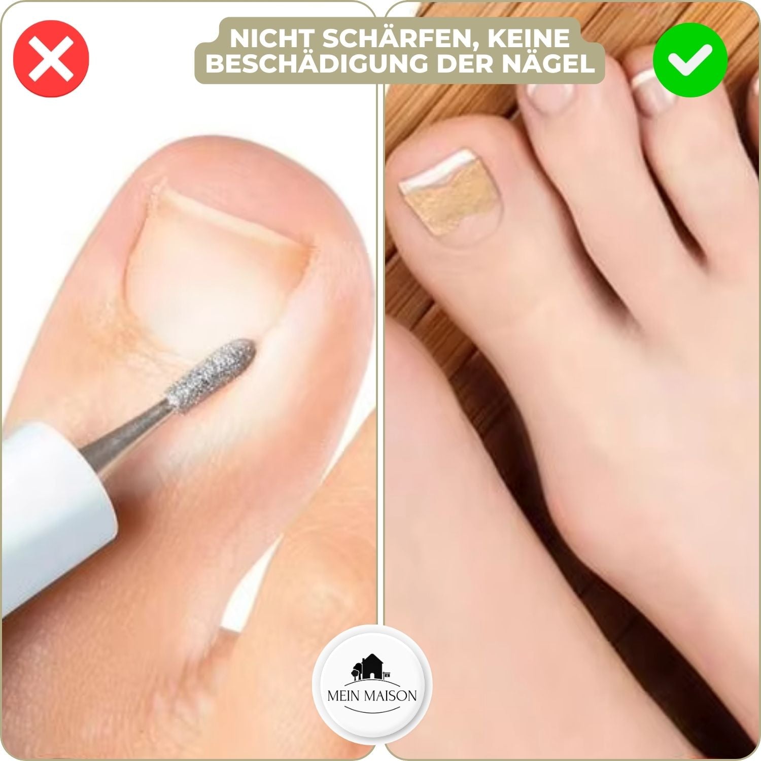 10+10 Gratis FixaNail Direkte Nagelreparatur