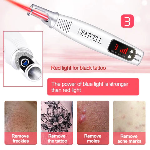 LumiDerm Home Laser Pen zur Entfernung von Tätowierungen, Muttermalen und Sommersprossen