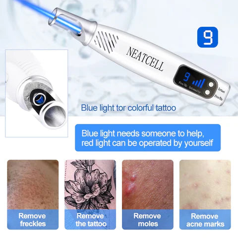 LumiDerm Home Laser Pen zur Entfernung von Tätowierungen, Muttermalen und Sommersprossen