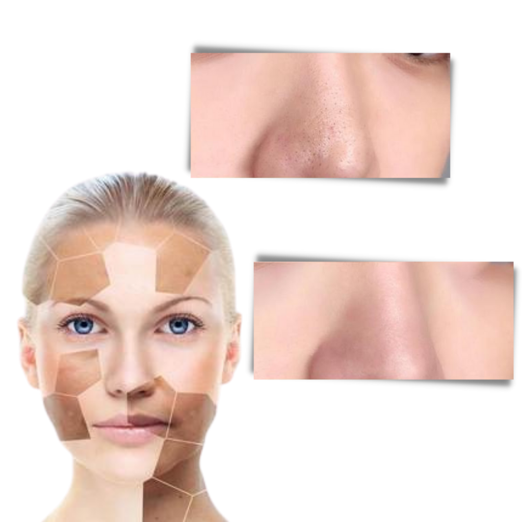 Poreless tiefenreinigende Entfernen von Mitessern Grüntee-Maske - 2+1 GRATIS