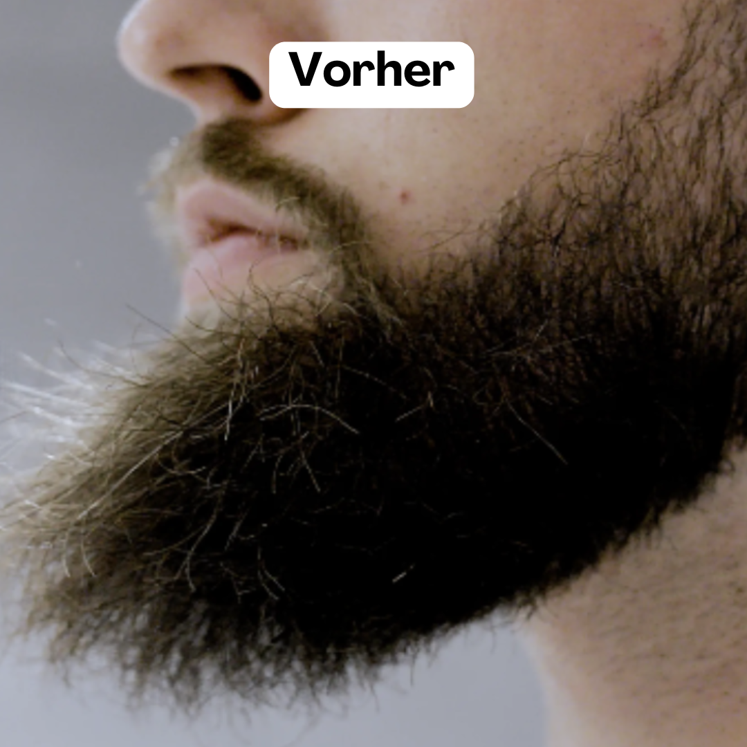 BeardMaster | Kabelloser negativer Ion-Bartstyler