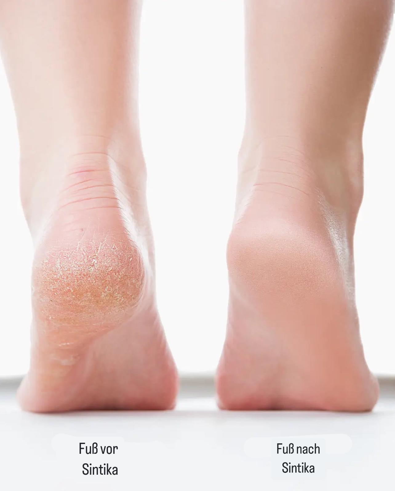 SmoothStep elektrische Fußfeile | Mühelose Pflege für schöne Füße