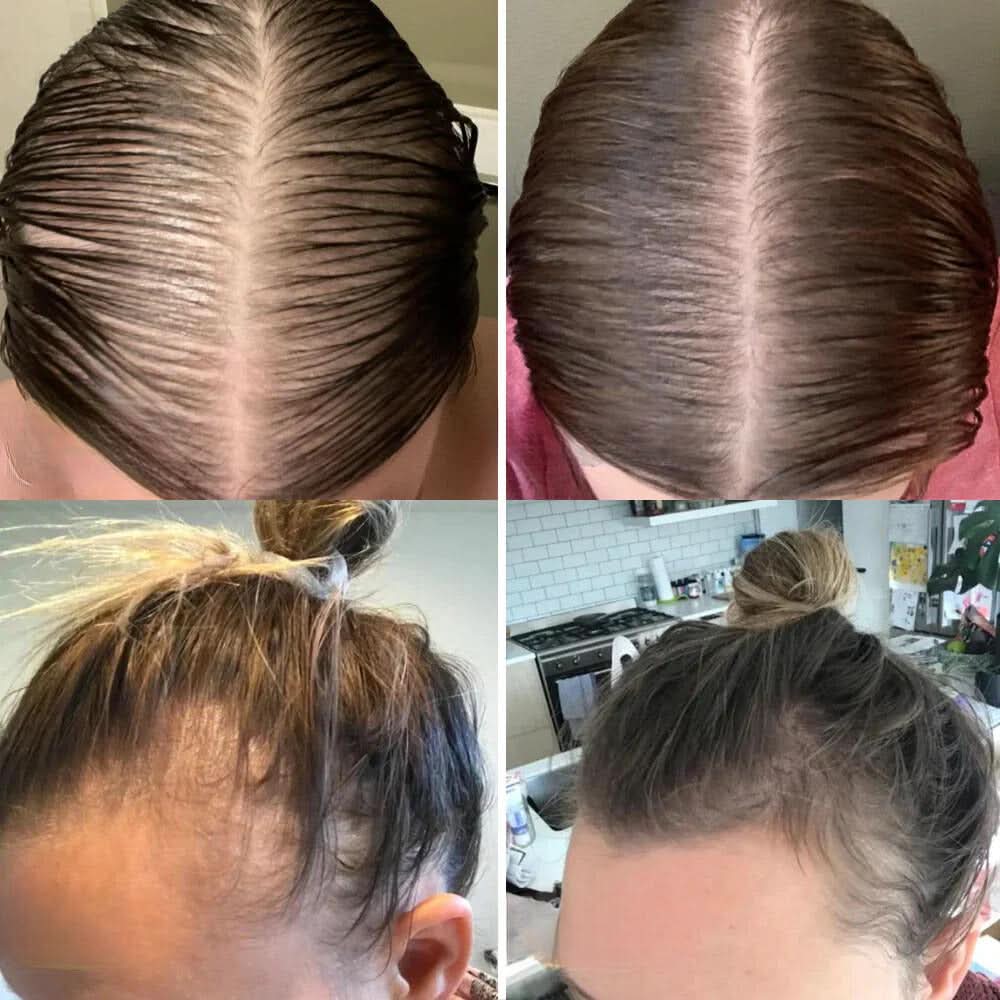Ihr natürliches Öl für Haarwachstum