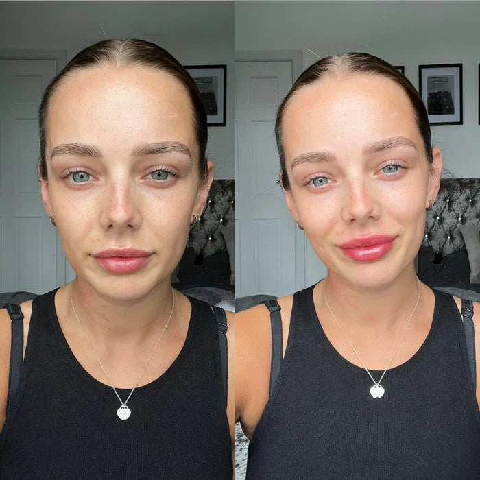 Sofortiges Lippenvolumen-Serum