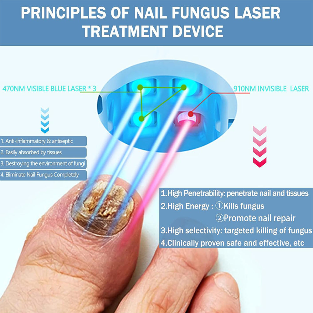 NexaLume Laser-Nagelpflegegerät für zu Hause - Einfach zu bedienen