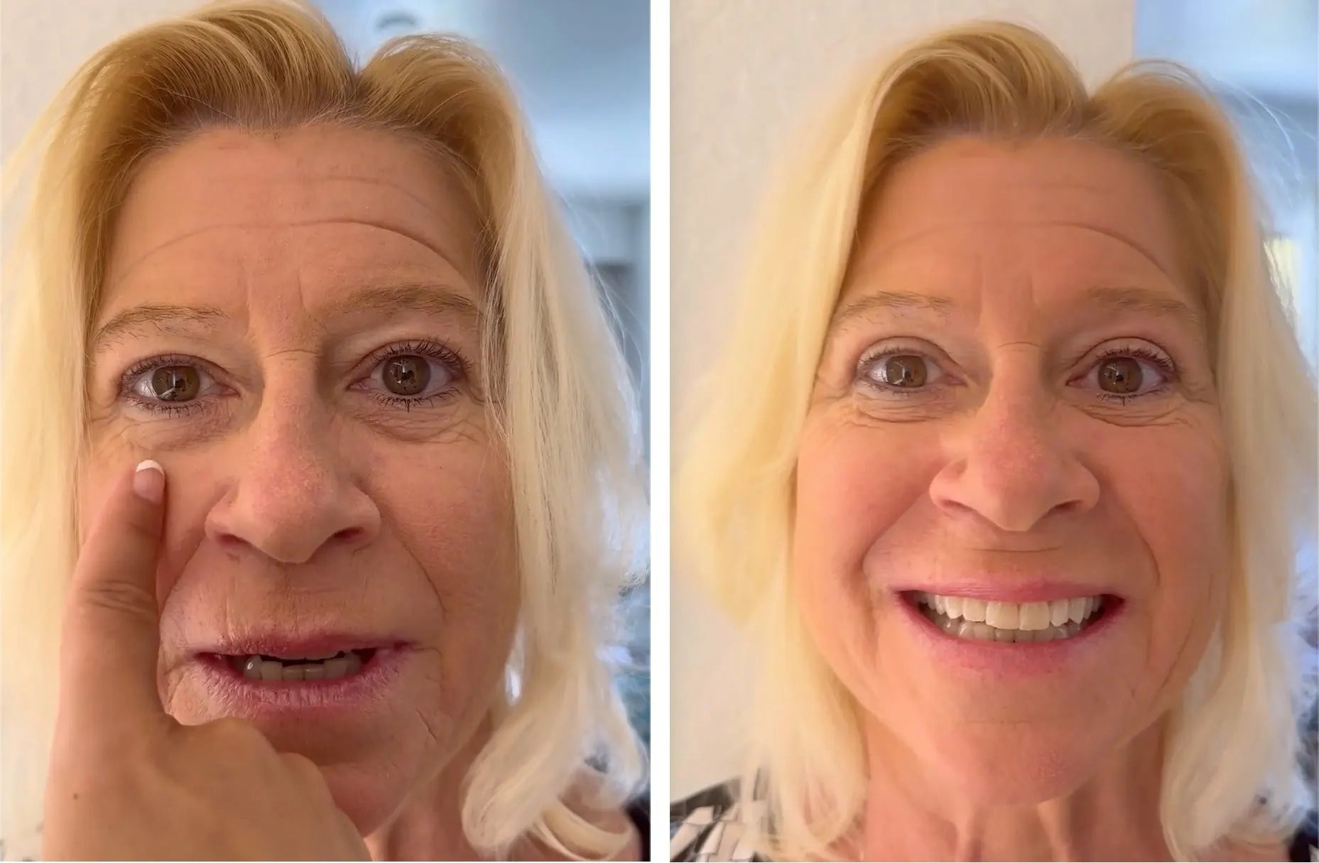 EyePerfection | Doppelte Augenlid Tape gegen hängendes Augenlid | Unisex