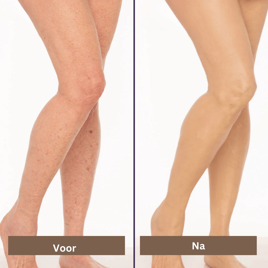 SmoothTone Hautpflege | Zum Abdecken von Narben, Adern, Akne und Sonnenflecken