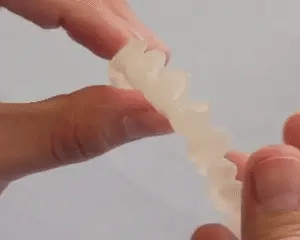 Snap-On Veneers von NovaBright schaffen ein schnelles, natürlich aussehendes Lächeln für obere und untere Zähne