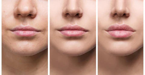 Sofortiges Lippenvolumen-Serum