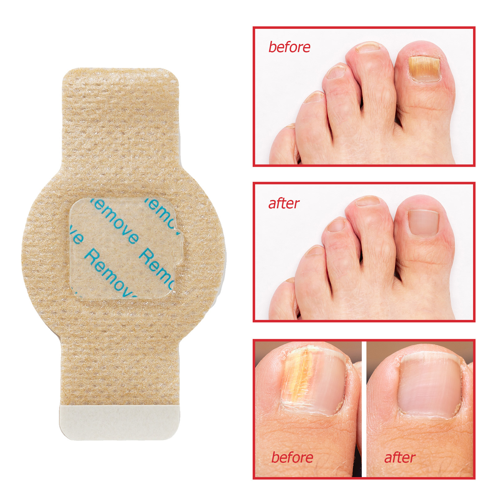 NailRevive™ – Gesunde Nägel zurück