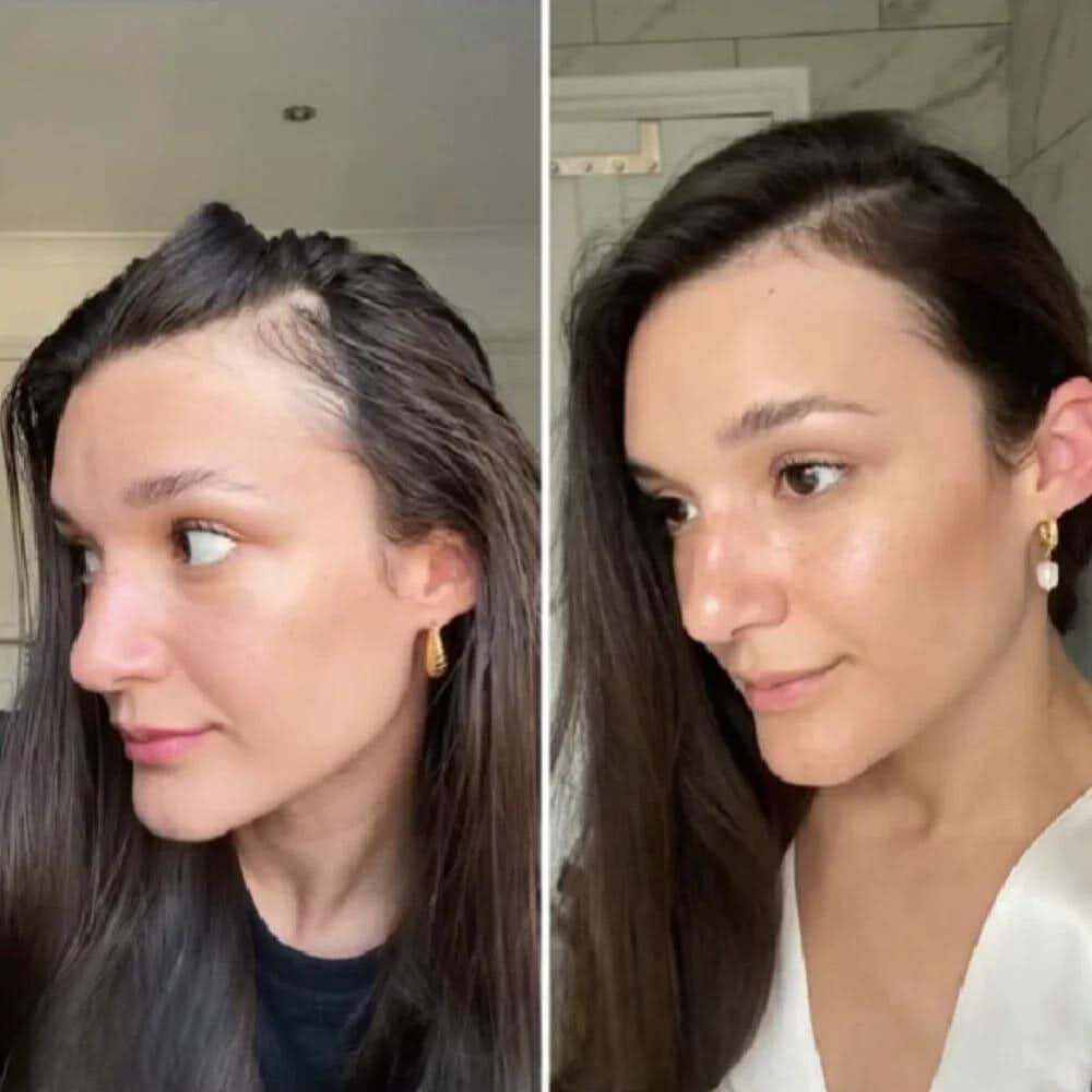 Ihr natürliches Öl für Haarwachstum