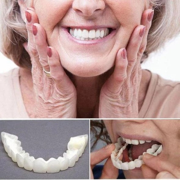 Auf Smile Veneers (Ober- und Unterkiefer inbegriffen)