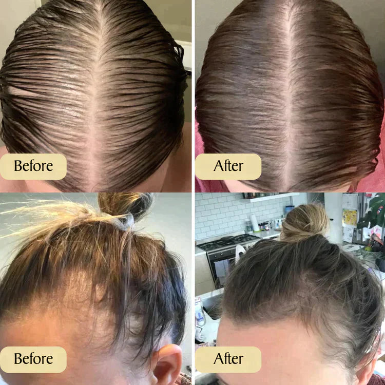 Natürliches Haarwachstumsöl