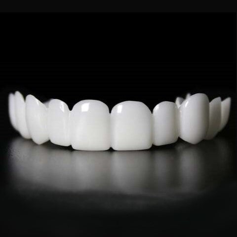 Snap-On Veneers von NovaBright schaffen ein schnelles, natürlich aussehendes Lächeln für obere und untere Zähne