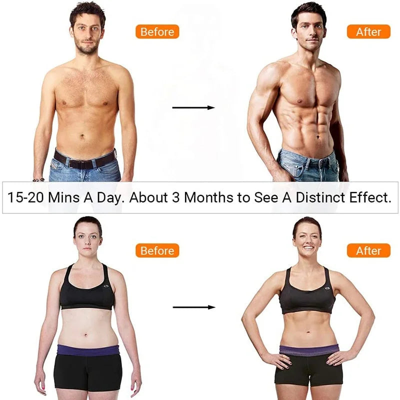 X Abs-Stimulator