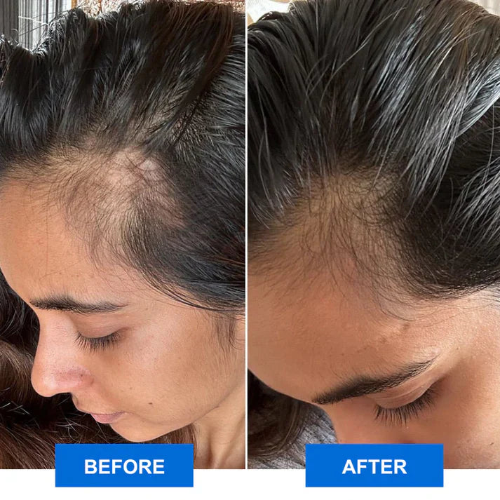 RelaxGlow Infrarot Kopfhautmassager | revitalisiere deine Kopfhaut, entspanne deinen Geist