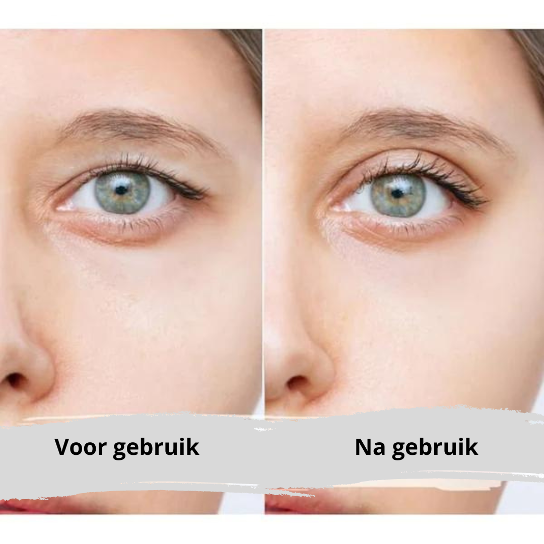 EyePerfection | Doppelte Augenlid Tape gegen hängendes Augenlid | Unisex