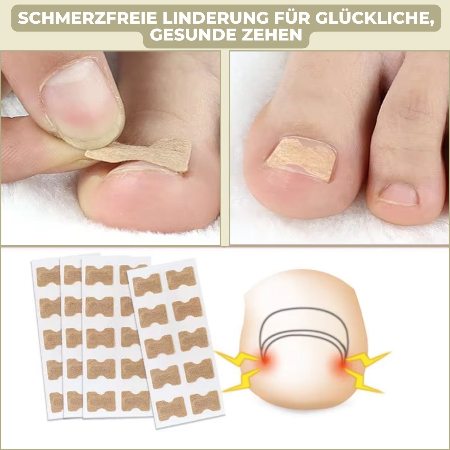 10+10 Gratis FixaNail Direkte Nagelreparatur