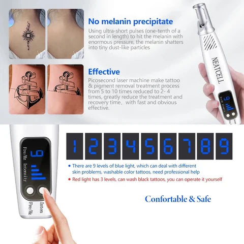 LumiDerm Home Laser Pen zur Entfernung von Tätowierungen, Muttermalen und Sommersprossen