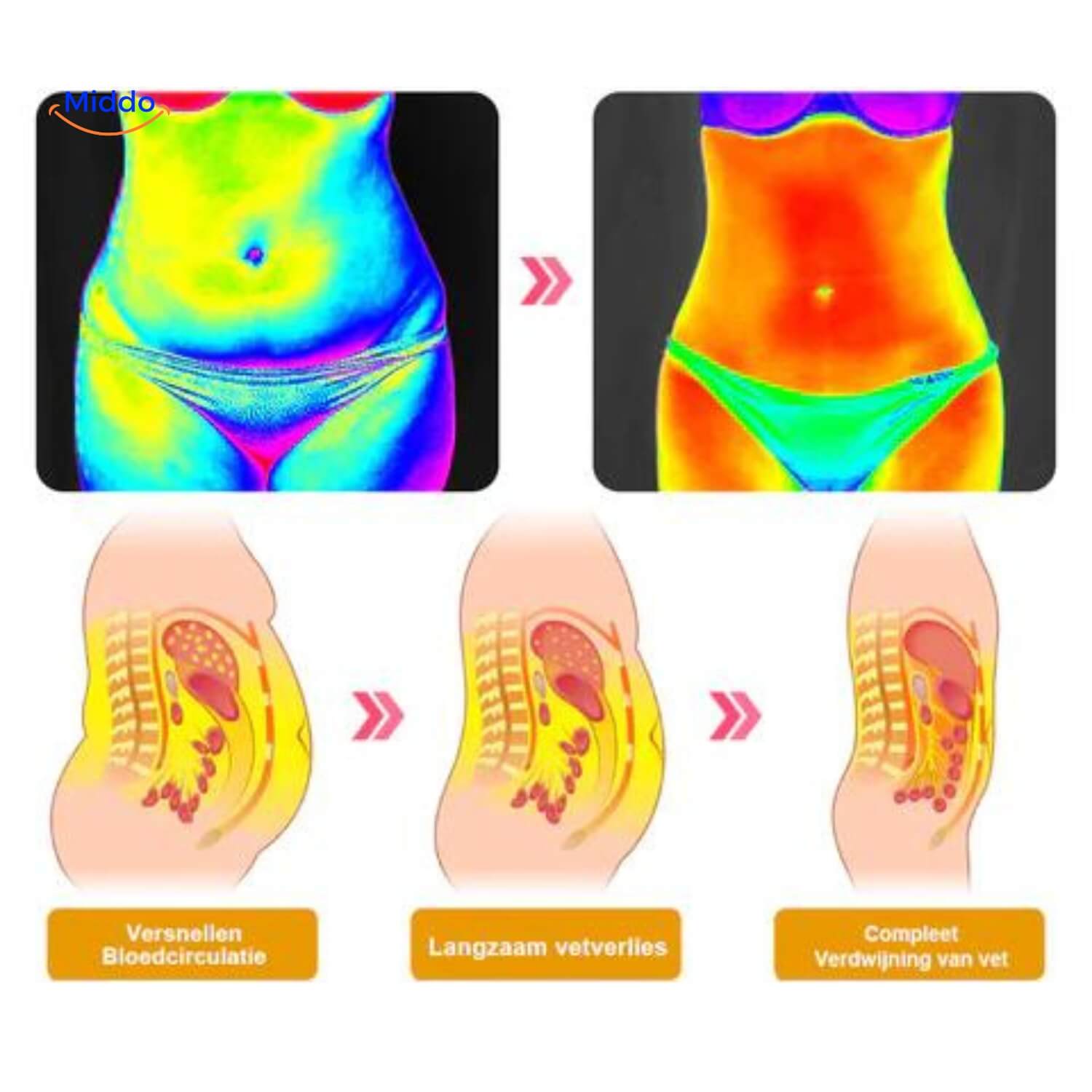 SilkShape Shaping Shorts | Für einen perfekt geformten Po und gezielte Fettverbrennung