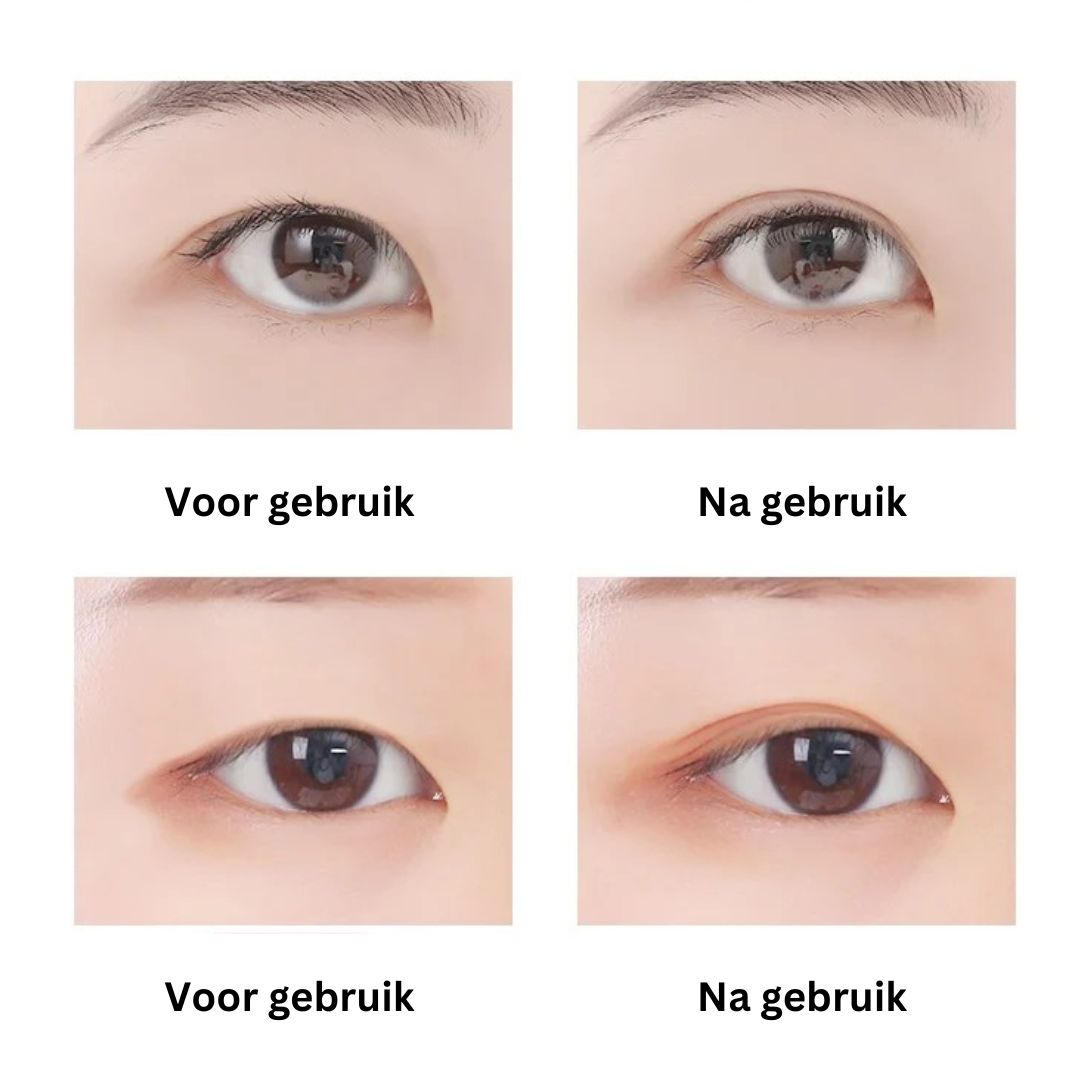 EyePerfection | Doppelte Augenlid Tape gegen hängendes Augenlid | Unisex