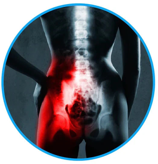 Sciatica Schmerz Linderungs Gürtel - beseitigen Sie Ihre Ischias- & Rückenschmerzen