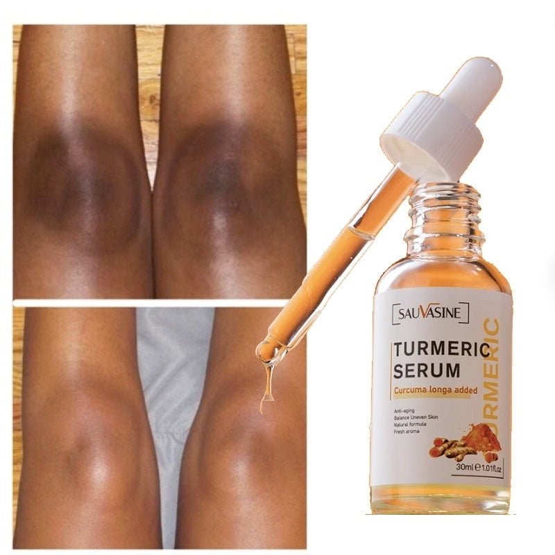 Kurkuma Dunkelheitsflecken-Korrekturserum