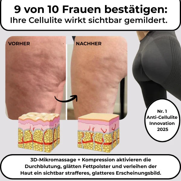 CompresFit | Premium Kompressionsleggings für verbesserte Leistungen