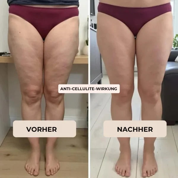 CompresFit | Premium Kompressionsleggings für verbesserte Leistungen
